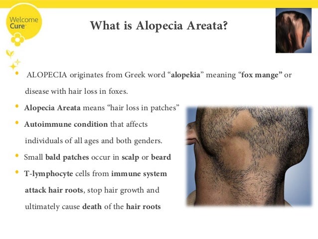 what is alopecia areata